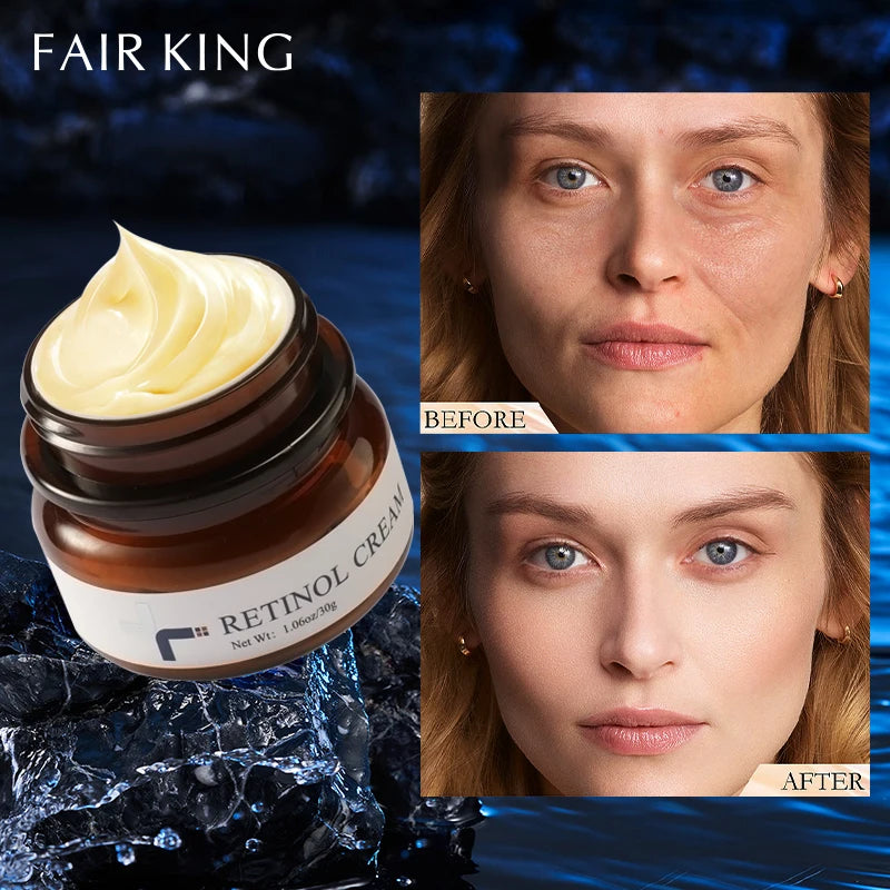 Anti-Wrinkle Face Cream
